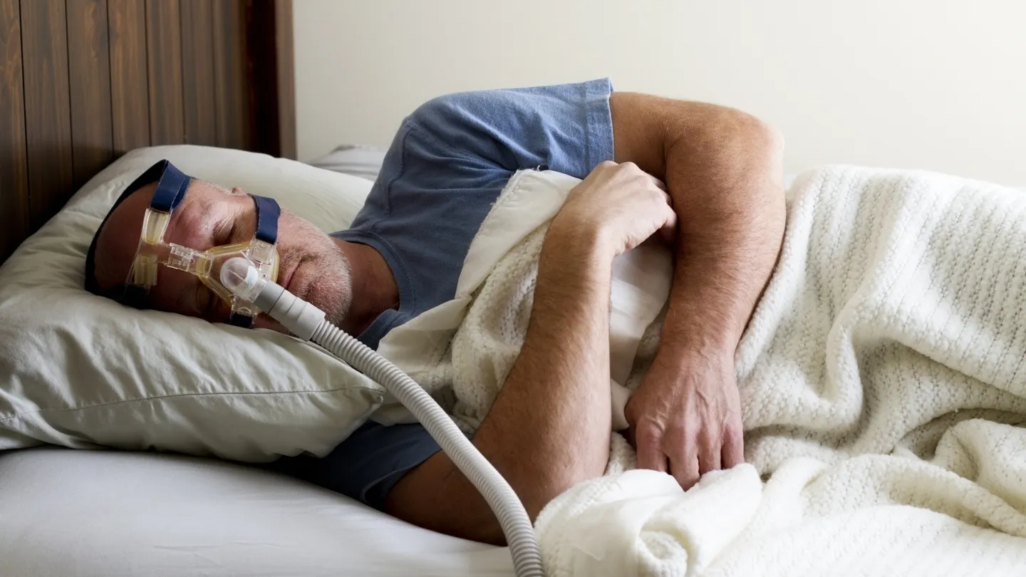 Apnea obstructiva del sueño
